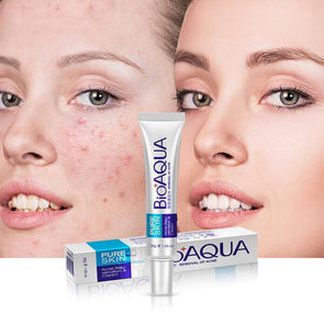 BIOAQUA Face Skin Care Acne Anti-Wrinkle Removal Cream